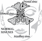 Normal Sinuses Effected by Sinusitis